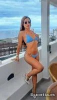 Noa photo 4