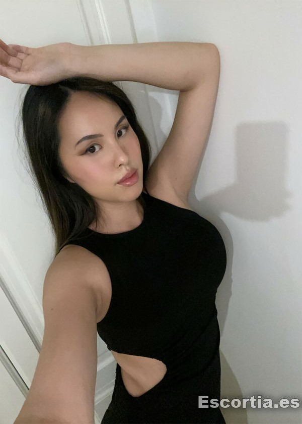 Xio photo 2